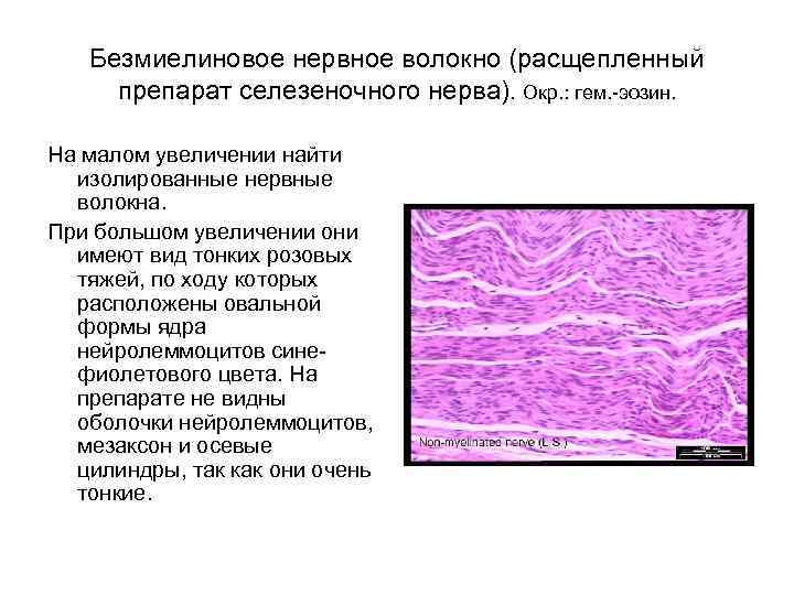 Безмиелиновое нервное волокно (расщепленный препарат селезеночного нерва). Окр. : гем. -эозин. На малом увеличении