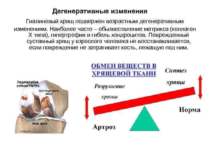 Дегенеративные изменения Гиалиновый хрящ подвержен возрастным дегенеративным изменениям. Наиболее часто – обызвествление матрикса (коллаген