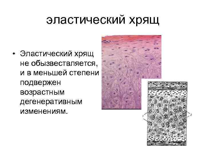 эластический хрящ • Эластический хрящ не обызвествляется, и в меньшей степени подвержен возрастным дегенеративным