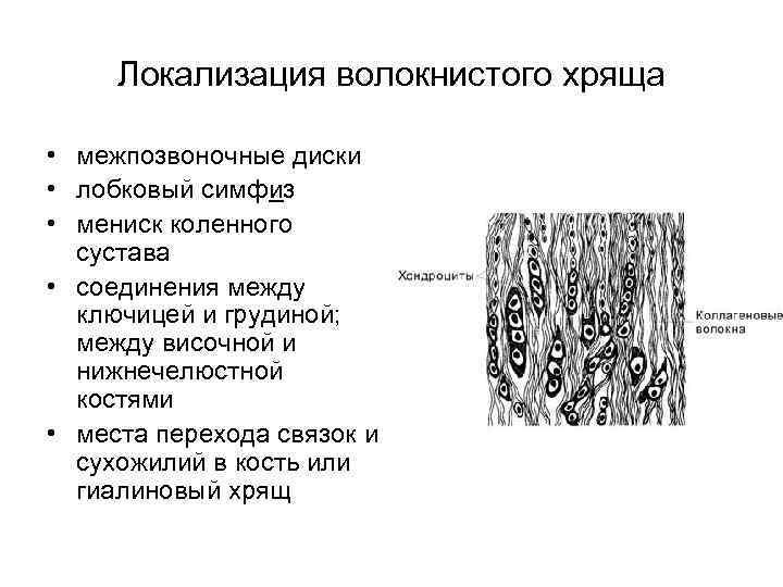 Волокнистый хрящ рисунок с подписями