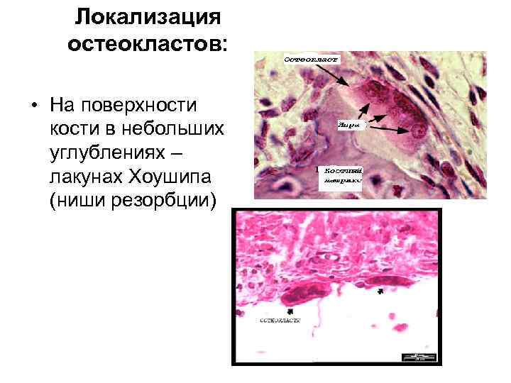 Локализация остеокластов: • На поверхности кости в небольших углублениях – лакунах Хоушипа (ниши резорбции)
