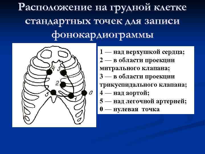 Расположение на грудной клетке стандартных точек для записи фонокардиограммы 1 — над верхушкой сердца;