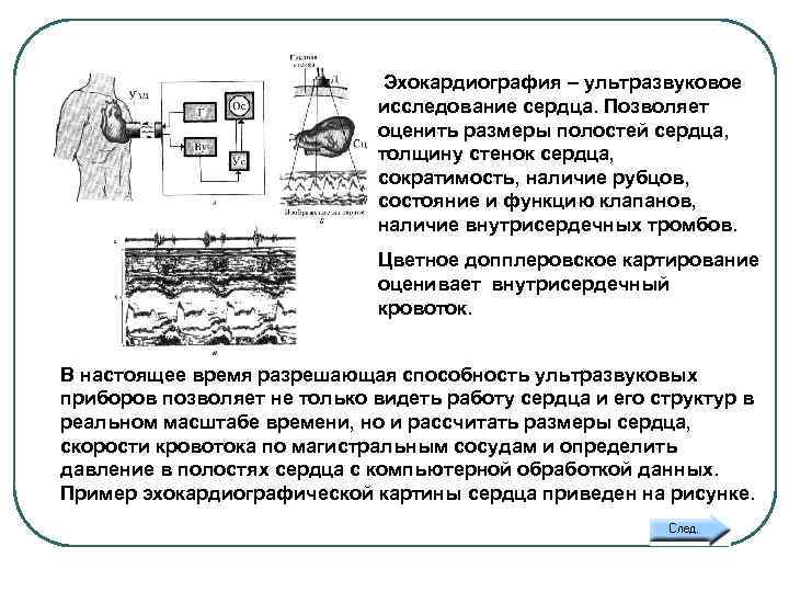 11 а. ЭХОКАРДИОГРАФИЯ Эхокардиография – ультразвуковое исследование сердца. Позволяет оценить размеры полостей сердца, толщину