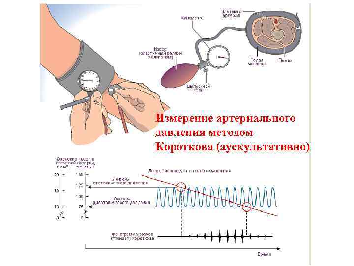 Измерение артериального давления методом Короткова (аускультативно) 