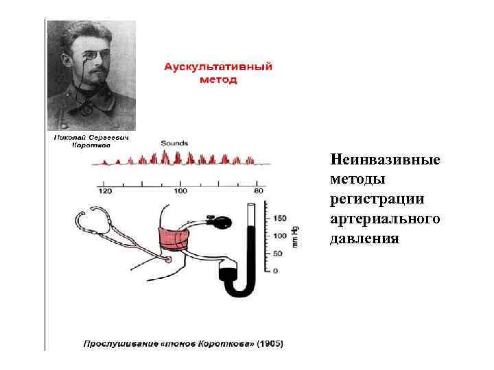 Неинвазивные методы регистрации артериального давления 