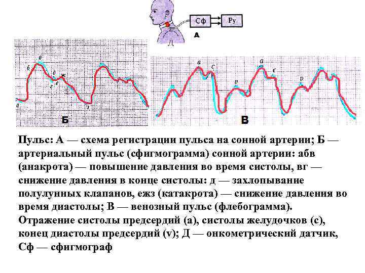 Равномерный пульс. Артериальный пульс схема. Сфигмограмма сонной артерии. Артериальный пульс сфигмограмма. Графическое изображение пульса.