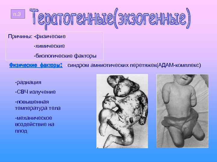 п. 3 Причины: -физические -химические -биологические факторы Физические факторы: -синдром амниотических перетяжек(АДАМ-комплекс) -радиация -СВЧ