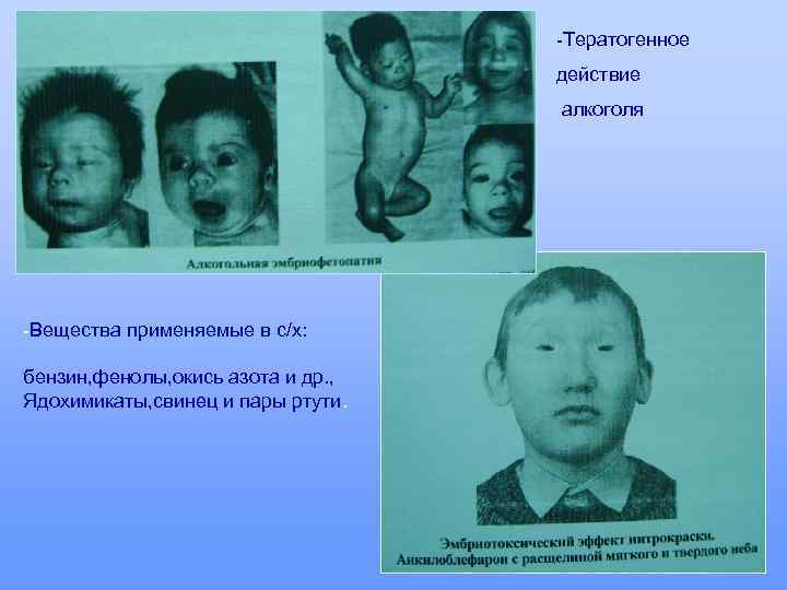 -Тератогенное действие алкоголя -Вещества применяемые в с/х: бензин, фенолы, окись азота и др. ,