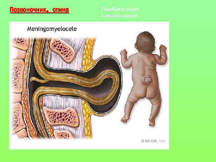 Позвоночник, спина -Люмбаоизация -Сакрализация 