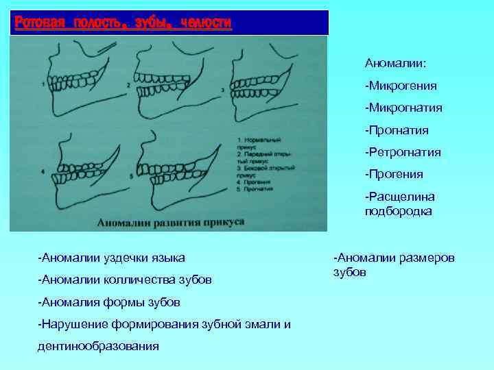 Фото прогения и прогнатия