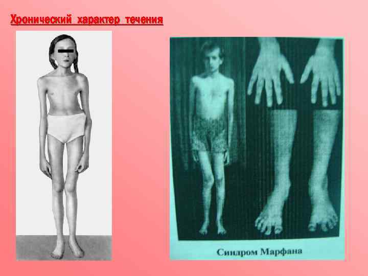 Хронический характер течения 