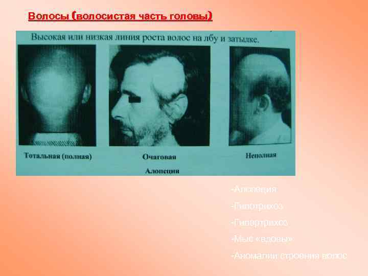 Волосы (волосистая часть головы) -Алопеция -Гипотрихоз -Гипертрихоз -Мыс «вдовы» -Аномалии строения волос 
