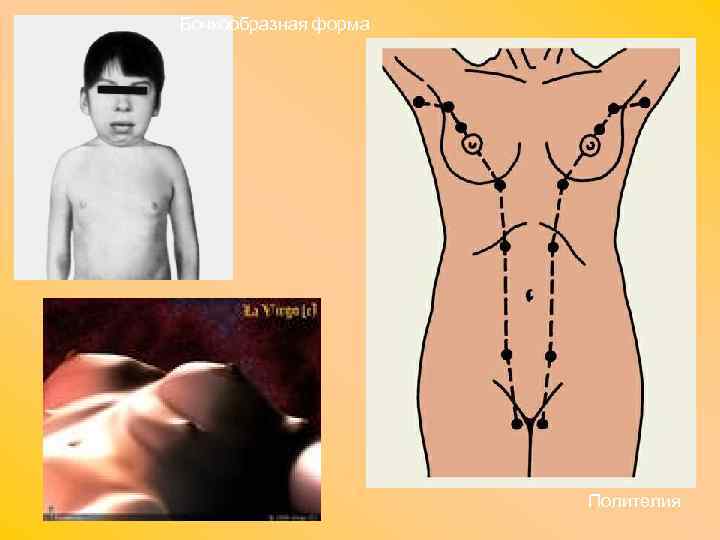 Бочкообразная форма Полителия 
