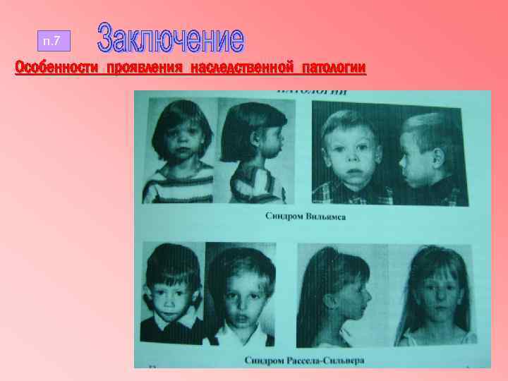 п. 7 Особенности проявления наследственной патологии 