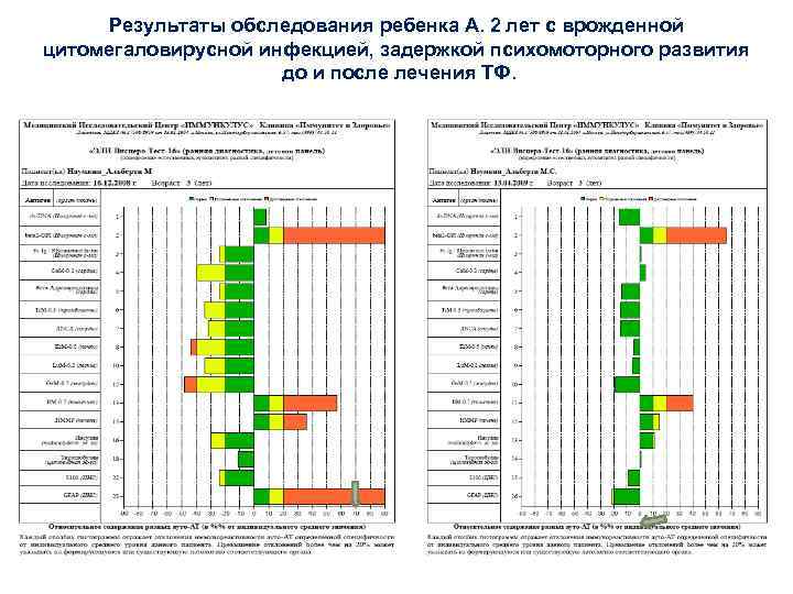 Результаты обследования ребенка А. 2 лет с врожденной цитомегаловирусной инфекцией, задержкой психомоторного развития до