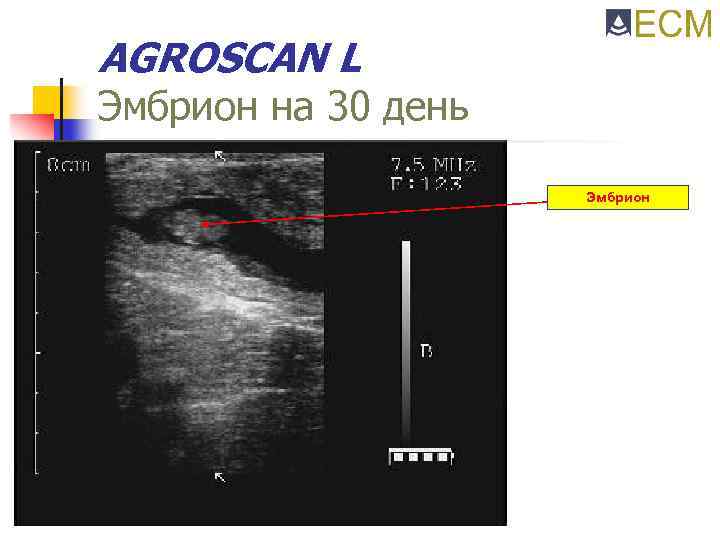 AGROSCAN L Эмбрион на 30 день Эмбрион 