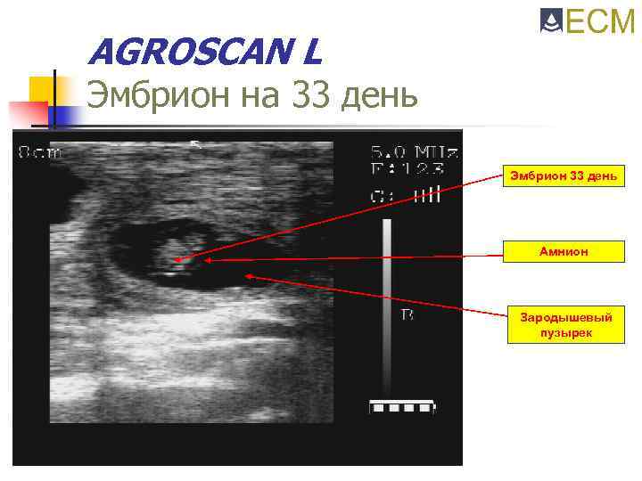 AGROSCAN L Эмбрион на 33 день Эмбрион 33 день Амнион Зародышевый пузырек 