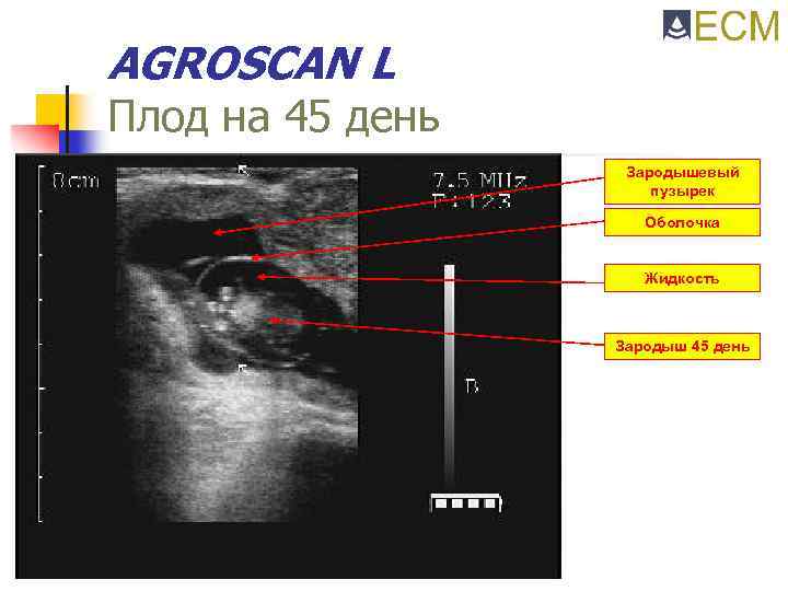 AGROSCAN L Плод на 45 день Зародышевый пузырек Оболочка Жидкость Зародыш 45 день 