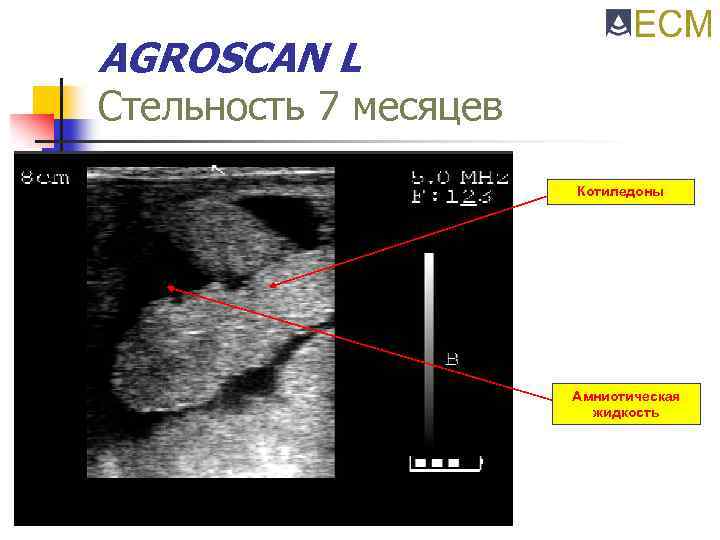 AGROSCAN L Стельность 7 месяцев Котиледоны Амниотическая жидкость 