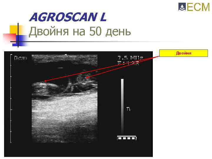 AGROSCAN L Двойня на 50 день Двойня 