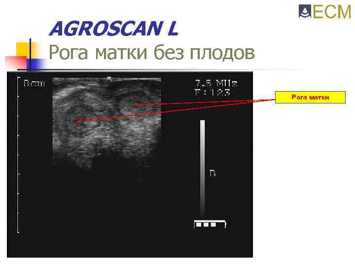 AGROSCAN L Рога матки без плодов Рога матки 