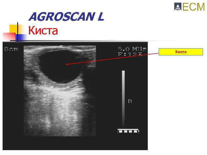 AGROSCAN L Киста 