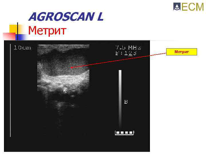 AGROSCAN L Метрит 