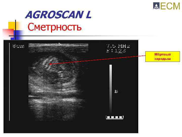 AGROSCAN L Сметрность Мёртвый зародыш 