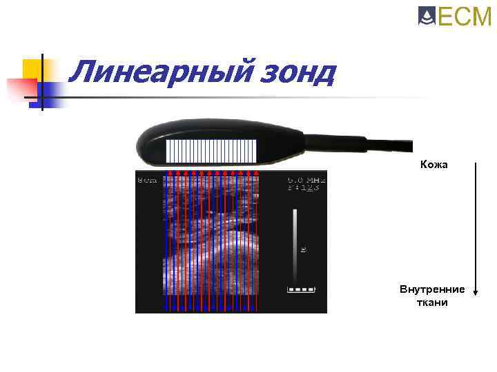 Линеарный зонд Кожа Внутренние ткани 