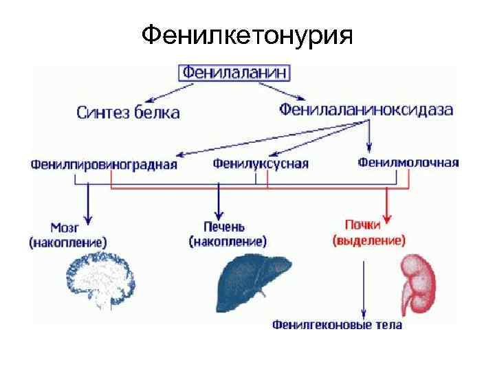 Фенилкетонурия 