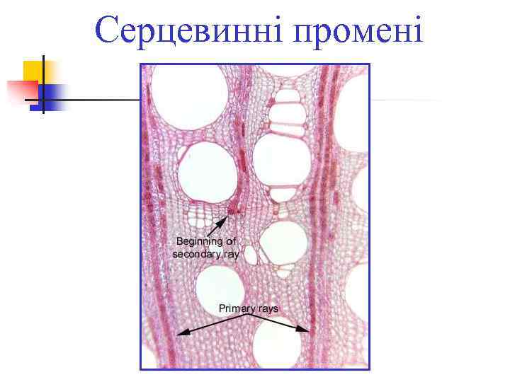 Серцевинні промені 