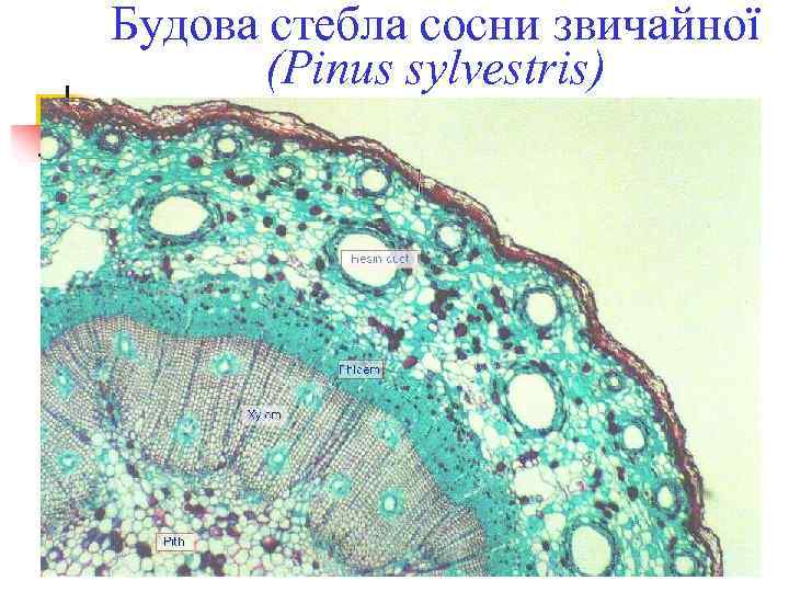 Будова стебла сосни звичайної (Pinus sylvestris) 