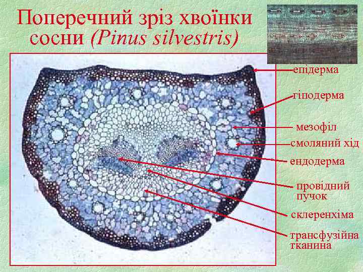 Поперечний зріз хвоїнки сосни (Pinus silvestris) епідерма гіподерма мезофіл смоляний хід ендодерма провідний пучок