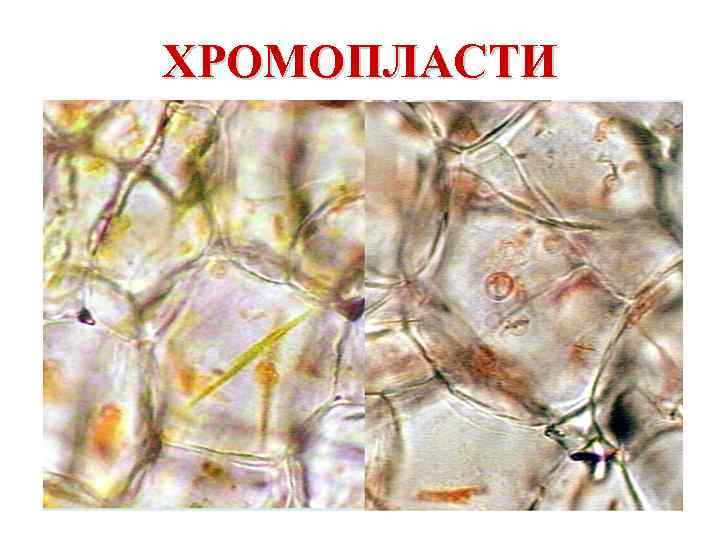 Клетка мякоти рябины. Хромопласты под микроскопом. Хромопласт микрофотография. Хромопласт в микроскопии.