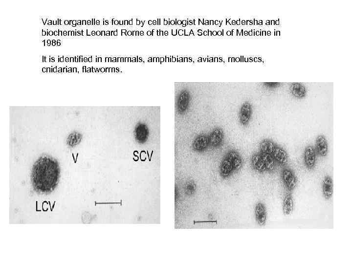 Vault organelle is found by cell biologist Nancy Kedersha and biochemist Leonard Rome of