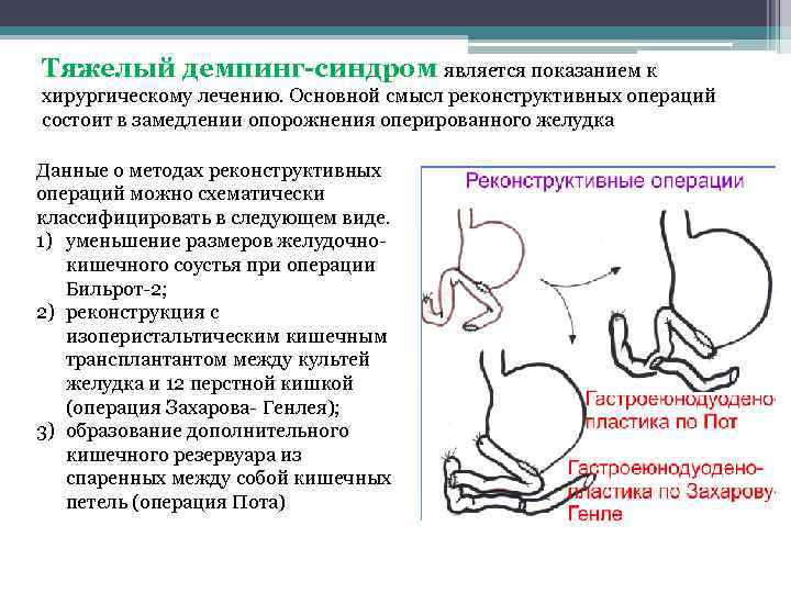 Тяжелый демпинг-синдром является показанием к хирургическому лечению. Основной смысл реконструктивных операций состоит в замедлении