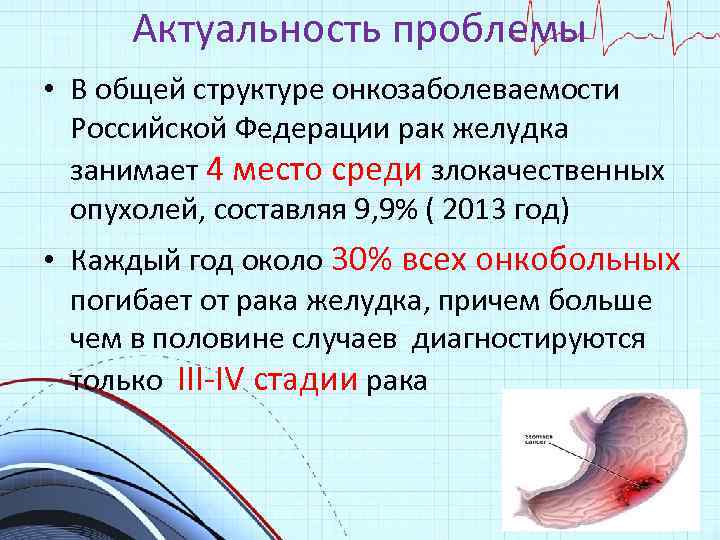 Актуальность проблемы • В общей структуре онкозаболеваемости Российской Федерации рак желудка занимает 4 место