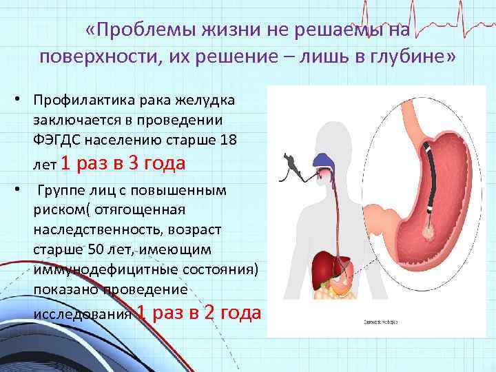  «Проблемы жизни не решаемы на поверхности, их решение – лишь в глубине» •