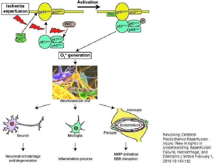 Revisiting Cerebral Postischemic Reperfusion Injury: New Insights in Understanding Reperfusion Failure, Hemorrhage, and Edema.