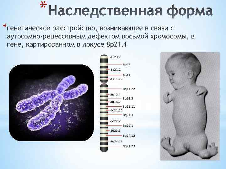 * *генетическое расстройство, возникающее в связи с аутосомно-рецессивным дефектом восьмой хромосомы, в гене, картированном