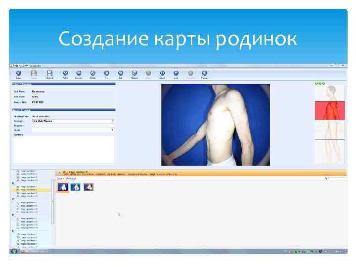 Создание карты родинок 