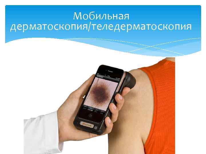 Мобильная дерматоскопия/теледерматоскопия 