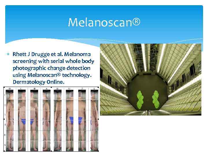Melanoscan® Rhett J Drugge et al. Melanoma screening with serial whole body photographic change