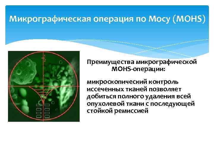 Микрографическая операция по Мосу (MOHS) Преимущества микрографической MOHS-операции: микроскопический контроль иссеченных тканей позволяет добиться