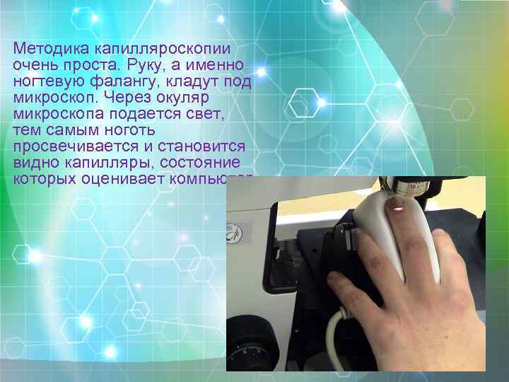 Методика капилляроскопии очень проста. Руку, а именно ногтевую фалангу, кладут под микроскоп. Через окуляр