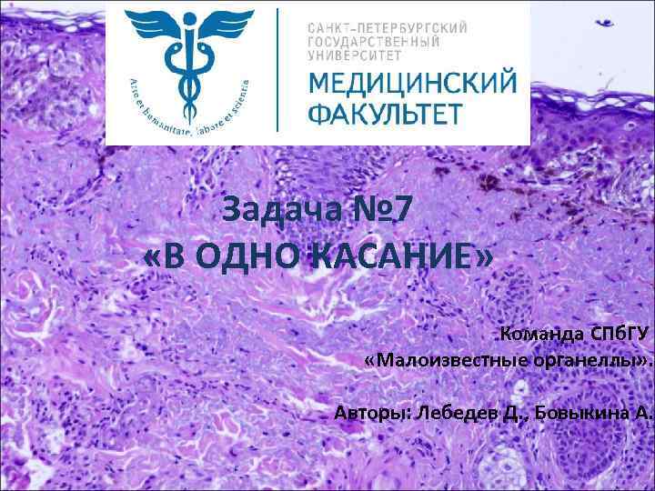 Задача № 7 «В ОДНО КАСАНИЕ» Команда СПб. ГУ «Малоизвестные органеллы» . Авторы: Лебедев