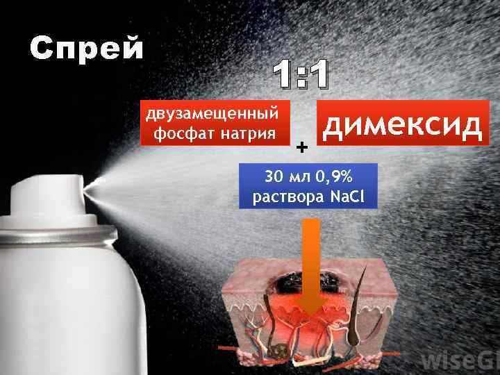 Спрей 1: 1 двузамещенный фосфат натрия + димексид 30 мл 0, 9% раствора Na.