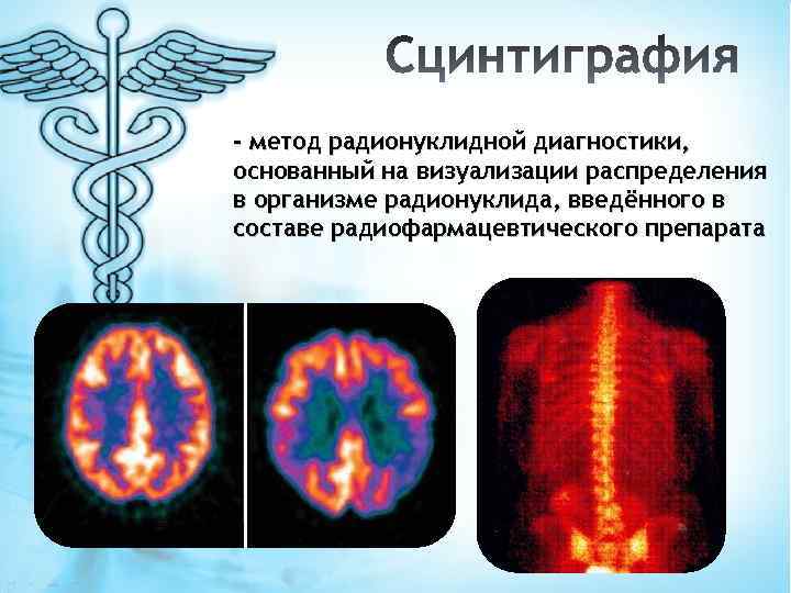- метод радионуклидной диагностики, основанный на визуализации распределения в организме радионуклида, введённого в составе