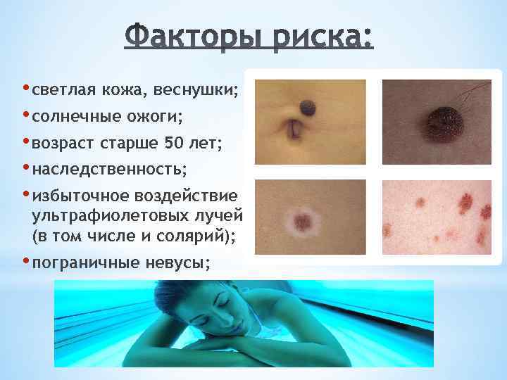  • светлая кожа, веснушки; • солнечные ожоги; • возраст старше 50 лет; •
