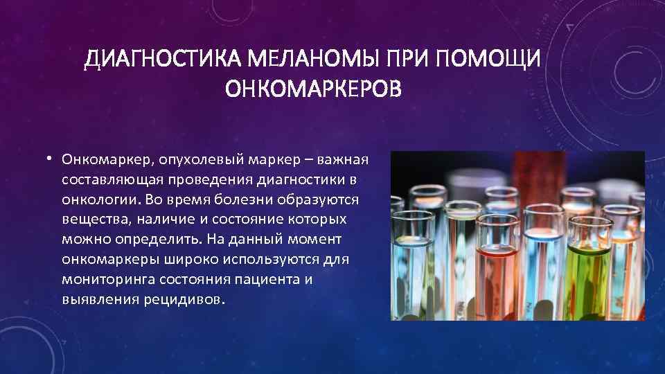 ДИАГНОСТИКА МЕЛАНОМЫ ПРИ ПОМОЩИ ОНКОМАРКЕРОВ • Онкомаркер, опухолевый маркер – важная составляющая проведения диагностики